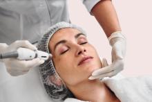 Microdermabrasion