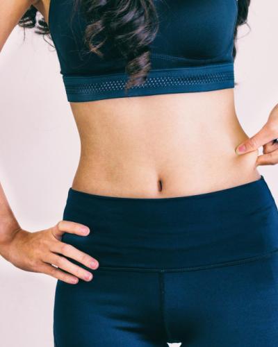 Laser Stretch Mark Reduction